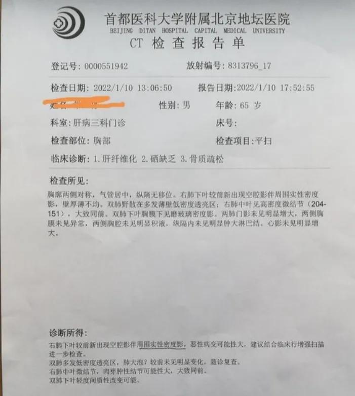 肺结节空泡征一年没变化,肺结节空泡一定恶性吗