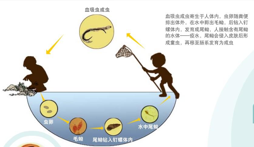 黄建荣教授：以肝损伤为主要表现的寄生虫病诊治进展
