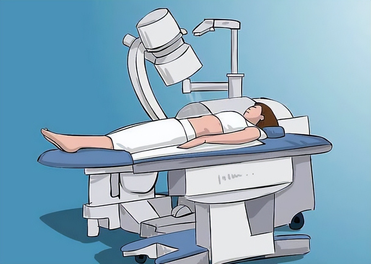 儿童有肾结石,儿童多发性肾结石