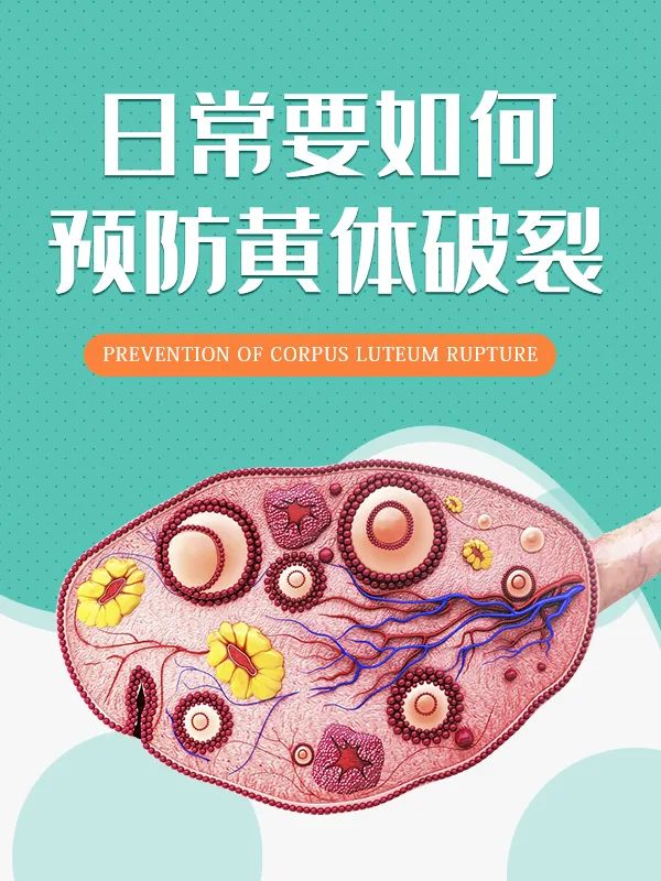 运动造成卵巢黄体破裂,跳操引起黄体破裂