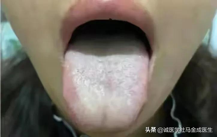 一补就上火的人怎么调理,舌苔上火怎么调理