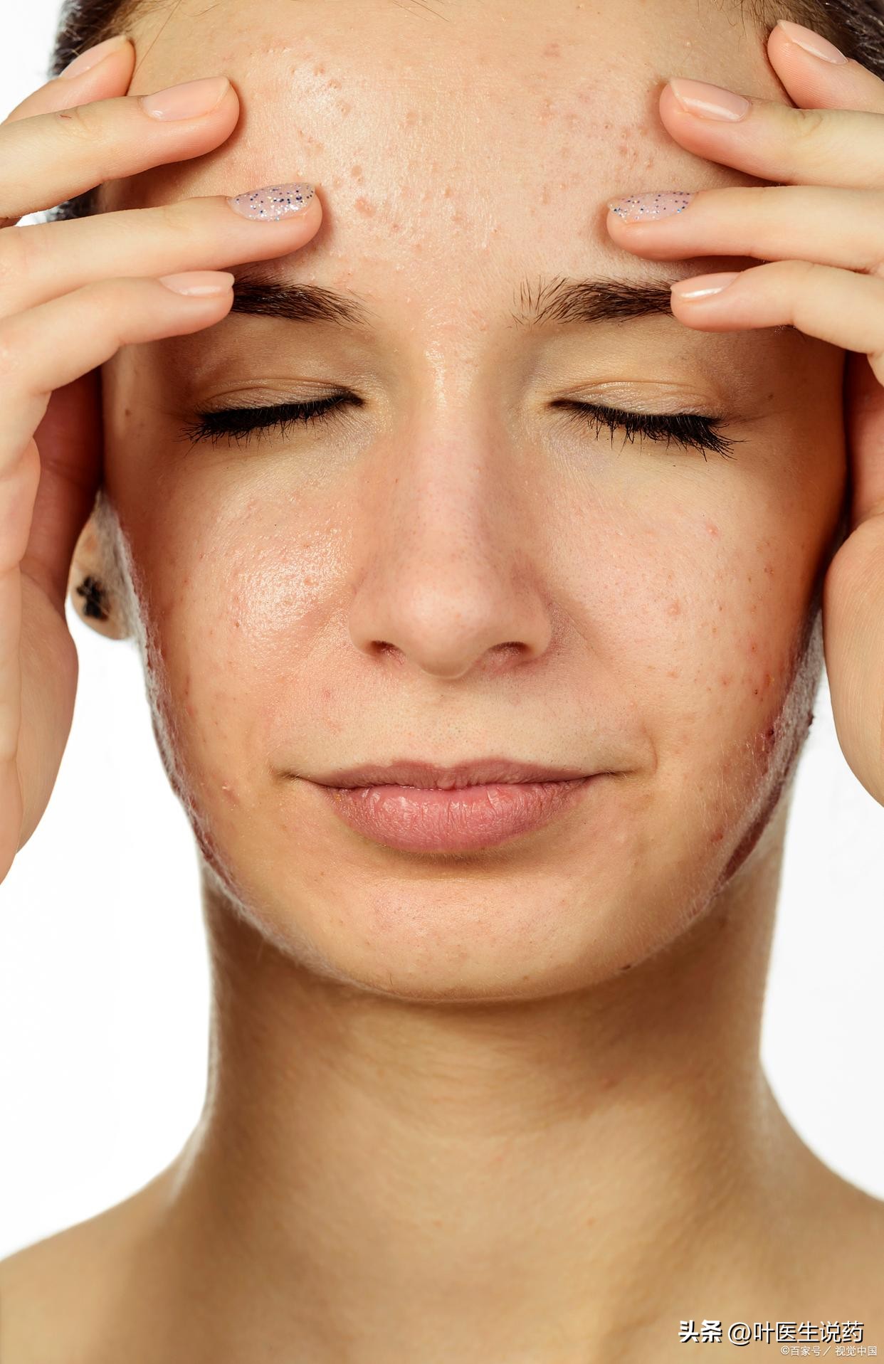 用什么药膏可以淡化色斑跟痘印,色斑皮肤用哪些产品好用