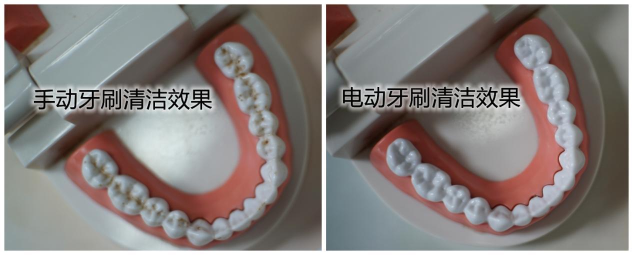 小学生电动牙刷的危害,电动牙刷危害科普