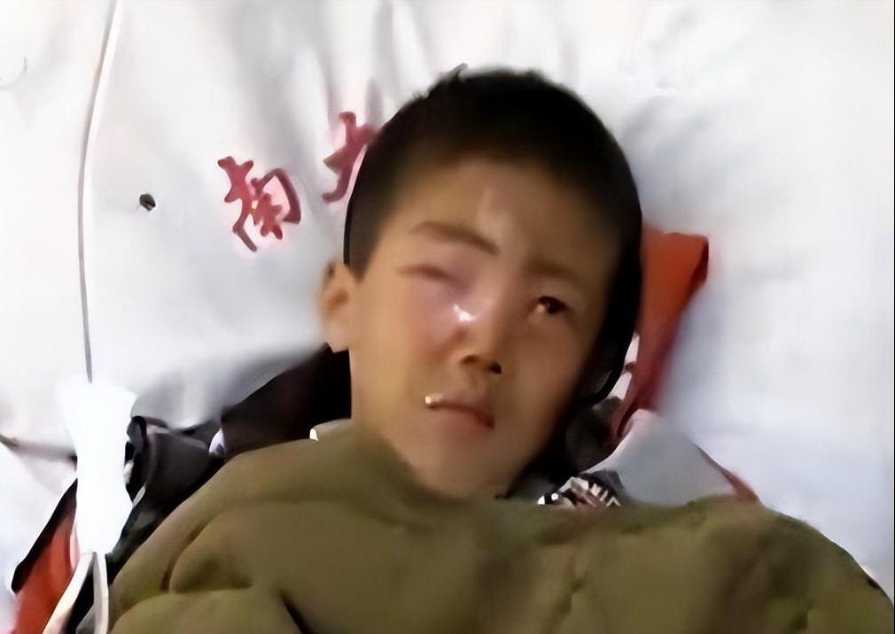 7岁男孩眼球被炸后融化,七岁男童眼睛秒被溶化