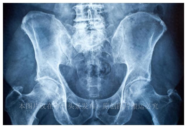 人类祖先的“丁丁”有骨头，现代人类怎么没有“丁丁骨”了呢？