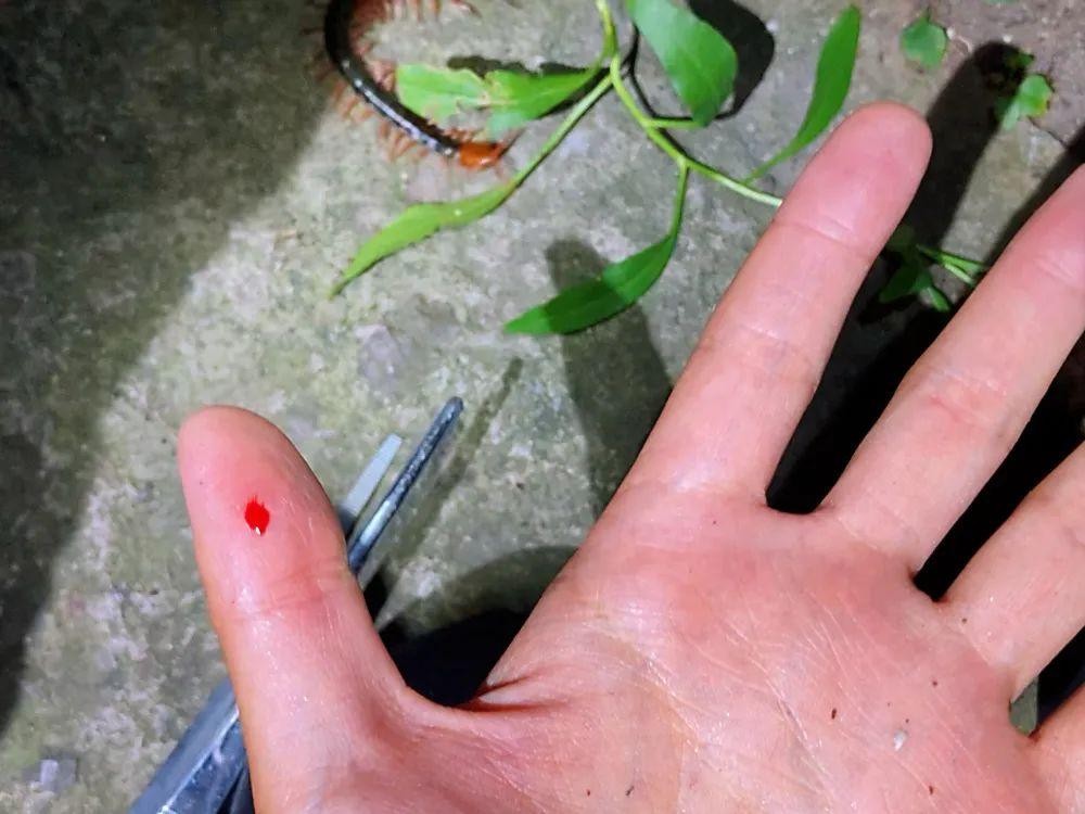 蜈蚣为什么是特别毒的虫,一般蜈蚣的毒性有多强