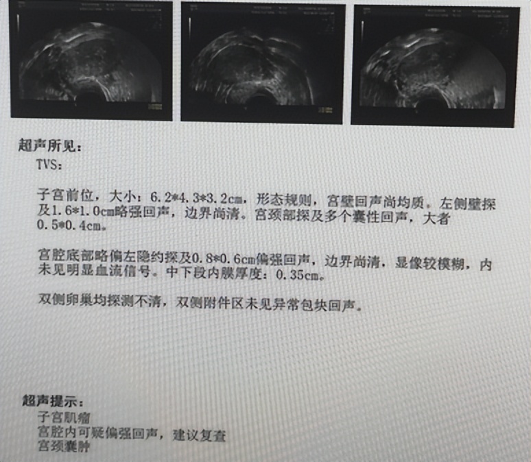 做了子宫内膜息肉会得癌症吗,息肉是肿瘤