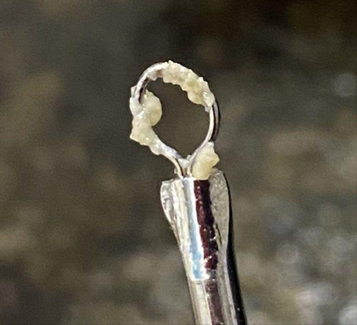 鼻子上有白白的小点可以挤吗,鼻子上黑黑的小点点怎么去除