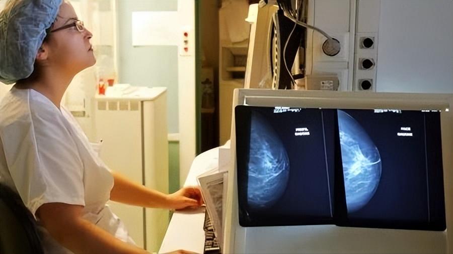 去医院做乳腺检查需要多长时间,乳腺增生的医院报告单看不懂