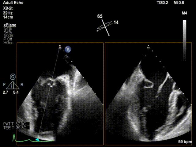 杨剑教授中国科学院,西京医院心血管外科杨剑