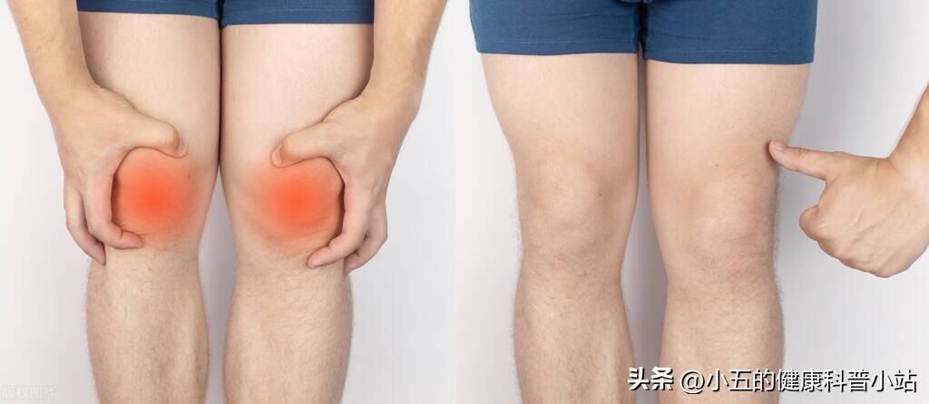 关节痛服塞来昔布多久见效,塞来昔布可以治疗肌肉酸痛