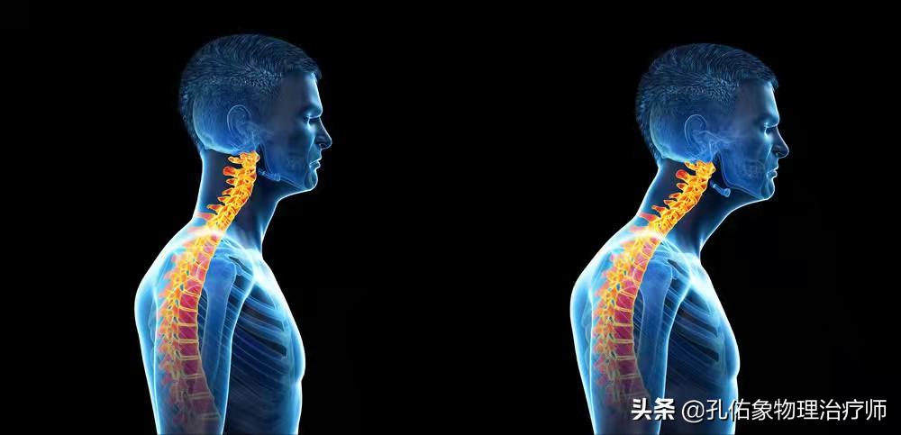 肩膀肌肉紧绷怎么放松,肩膀僵硬不放松怎么办