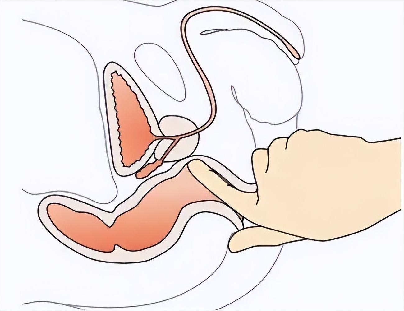 深圳女子去医院检查，回家后感觉肛门剧痛，怀疑医生性侵索赔20万