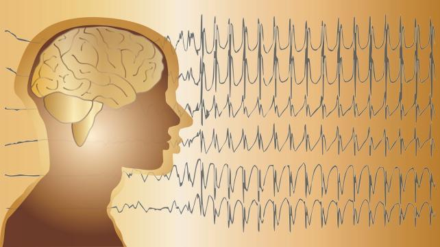 精神分裂人格分裂的前兆,人格分裂是精神分裂的表现症状