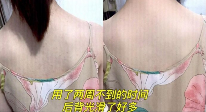 被妇产科列入黑名单的婴儿沐浴露,孕妇沐浴露禁用的成分澳宝