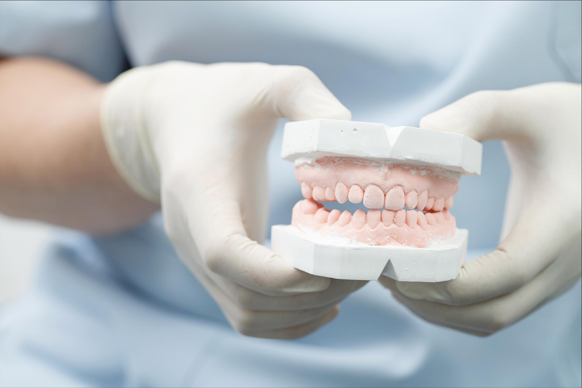 牙齿贴面的材料和品牌区别,牙贴面品牌十大排名最新