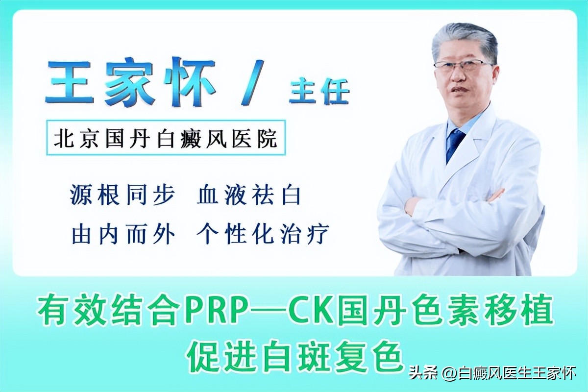 白癜风夏天锻炼方法,白癜风夏季养生攻略