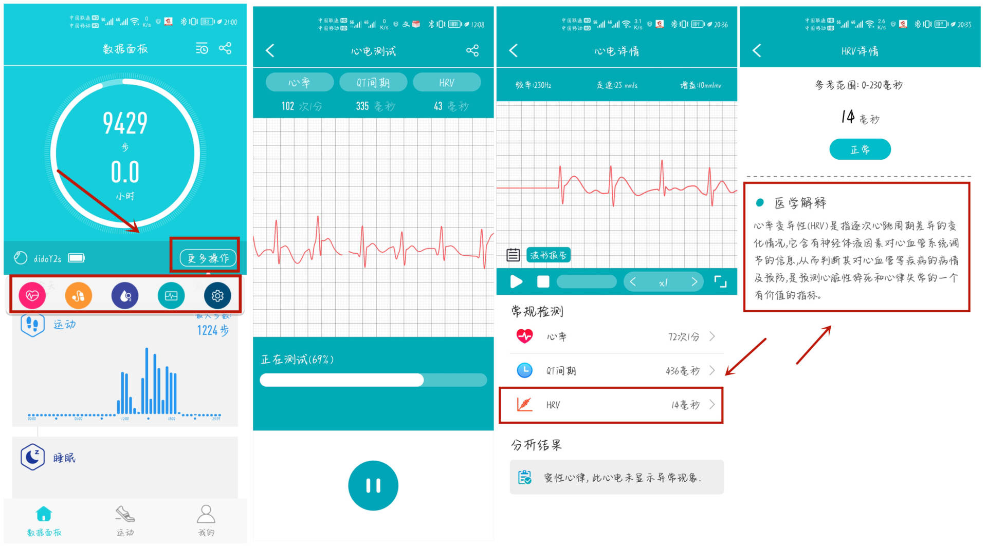 dido智能手环血压监测设置,dido手环y20测评