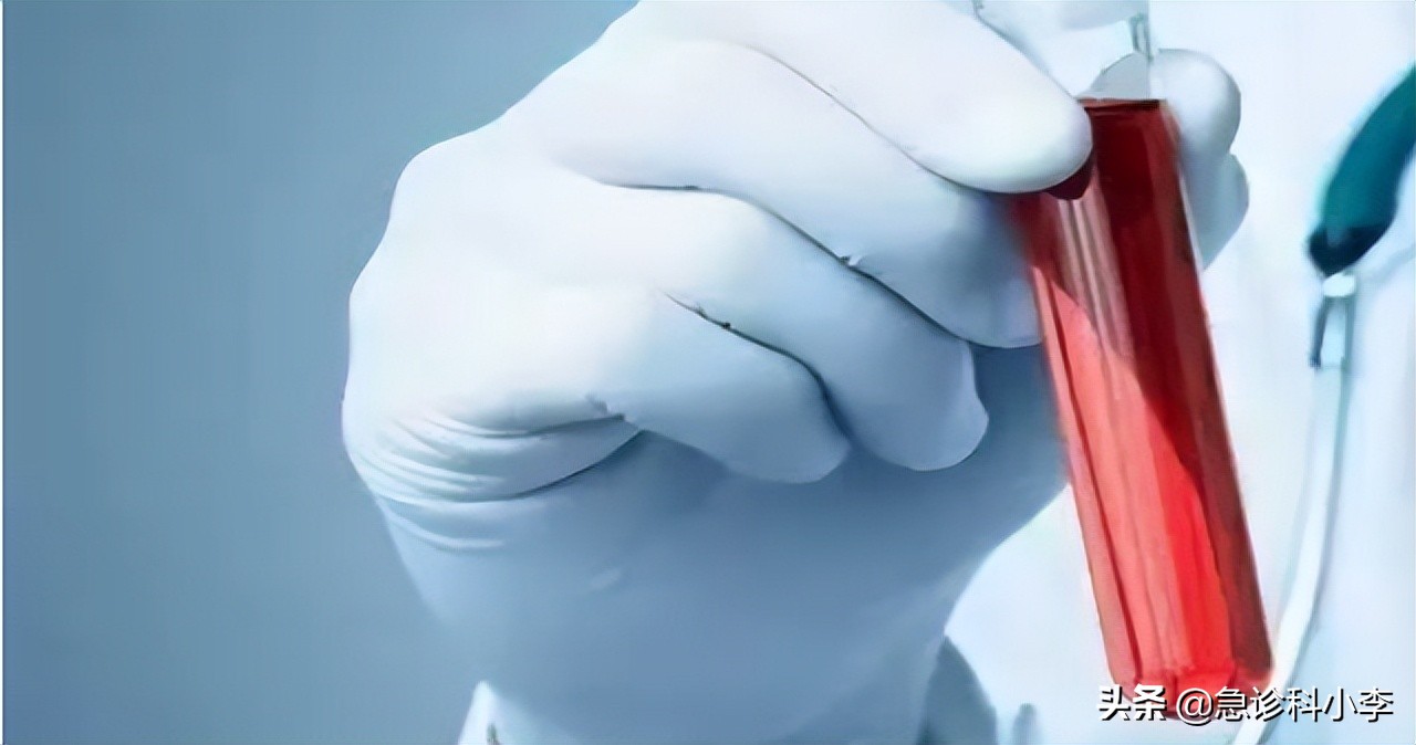 老年人感染艾滋病的高危行为,越来越多的老人得艾滋病