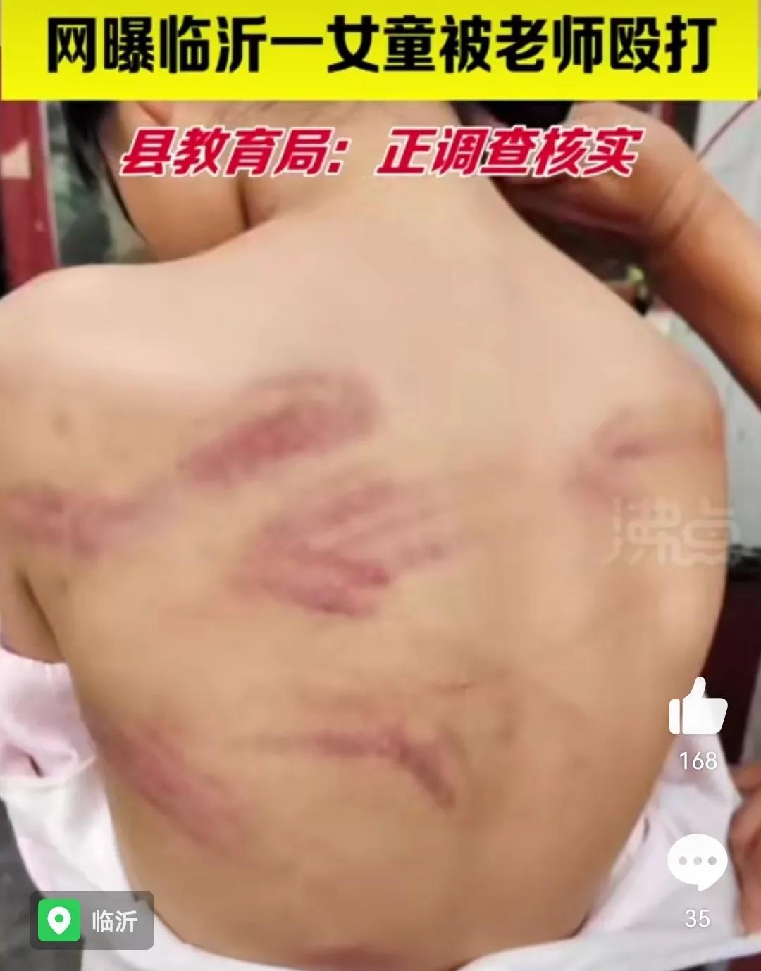 幼儿园孩子被老师虐待后怎么处理,孩子在幼儿园被老师虐待如何处理