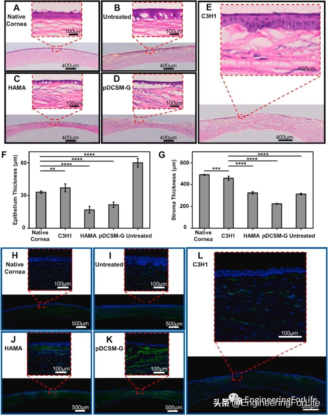 无需供体、无需缝合的双交联光固化人工角膜
