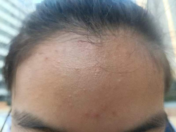 小叶医探,儿童长的恒牙是锯齿状的