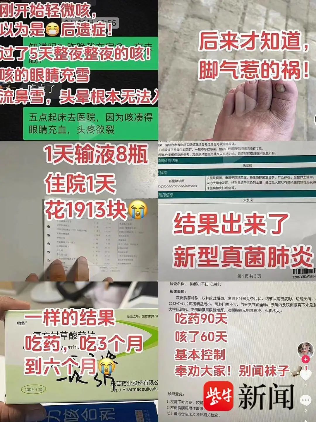 闻袜子得肺炎的案例,医生解读女子闻袜子感染真菌肺炎