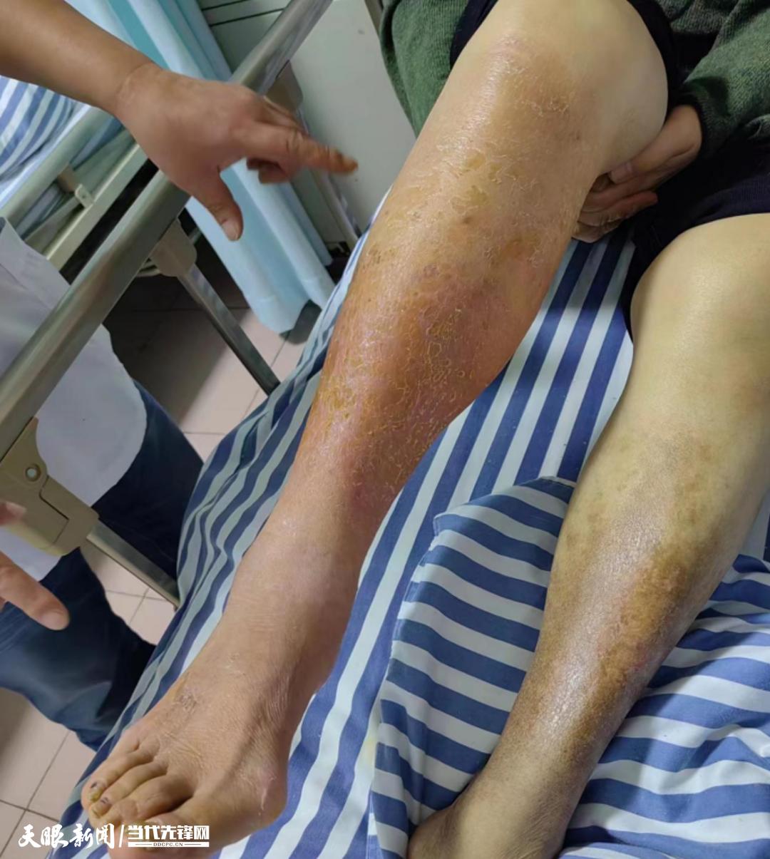 遵义治疗皮肤病最好的医院,遵义专治皮肤病的在哪里