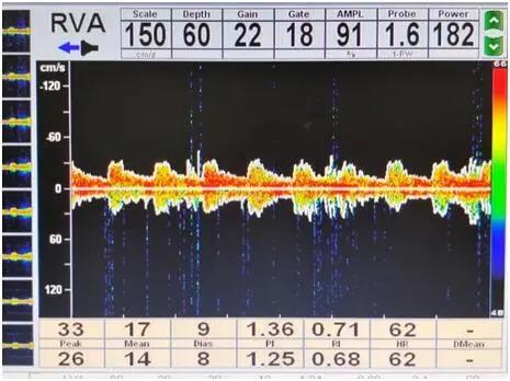 小小竞技支架,小小支撑架