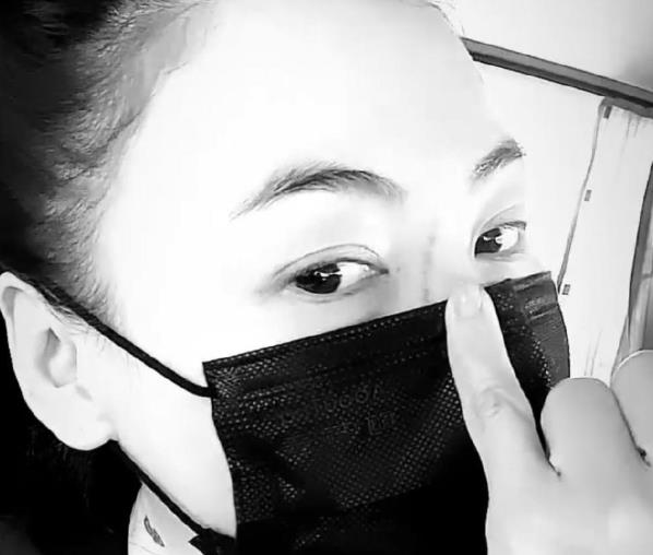 张柏芝手臂伤疤被曝照片,张柏芝被自家宠物狗咬伤视频