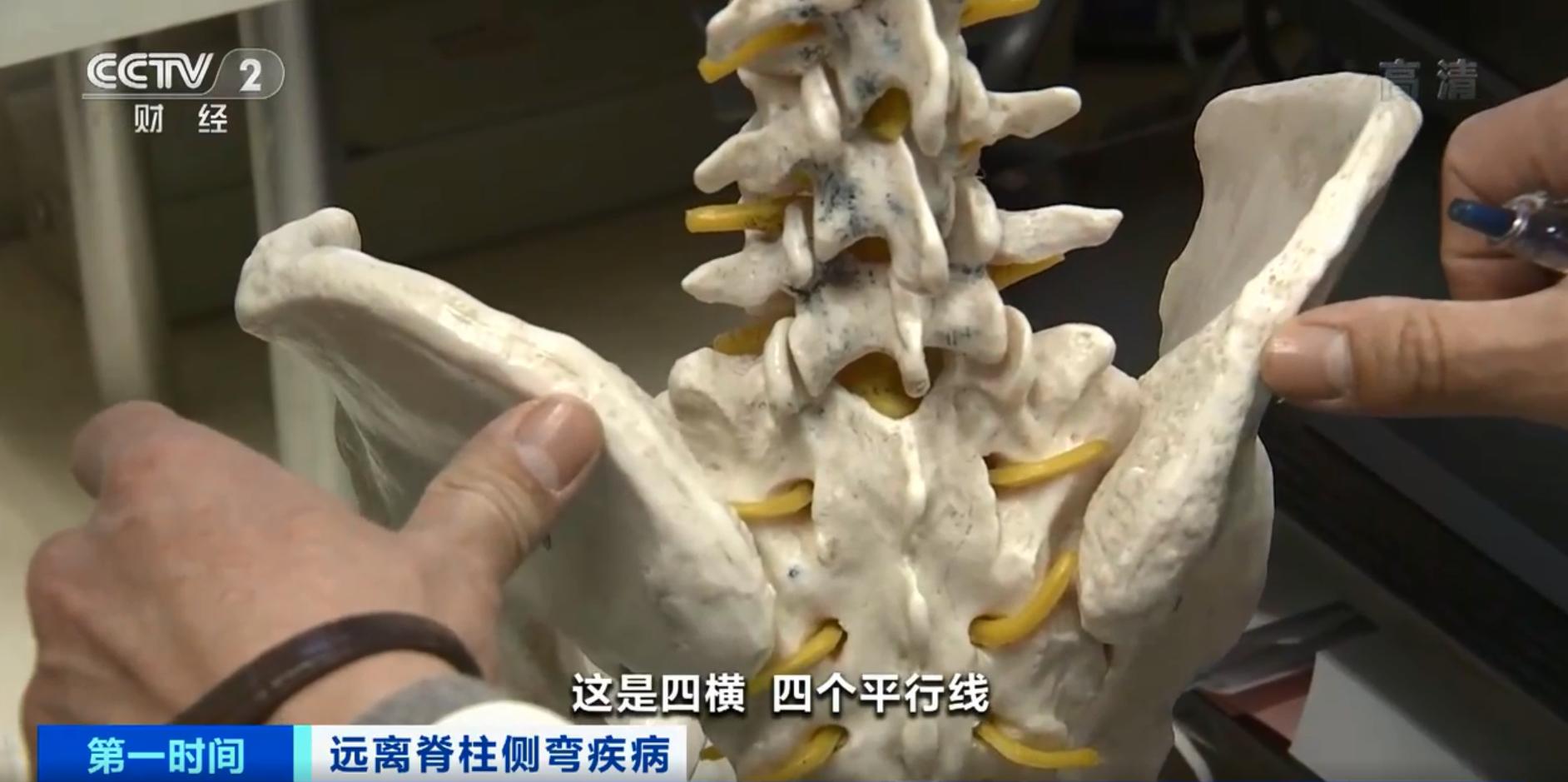 警惕青少年脊柱侧弯早预防早治疗,怎么防止十几岁的孩子脊柱侧弯