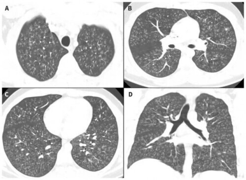 电子烟的危害骗局,电子烟危害大是骗局吗