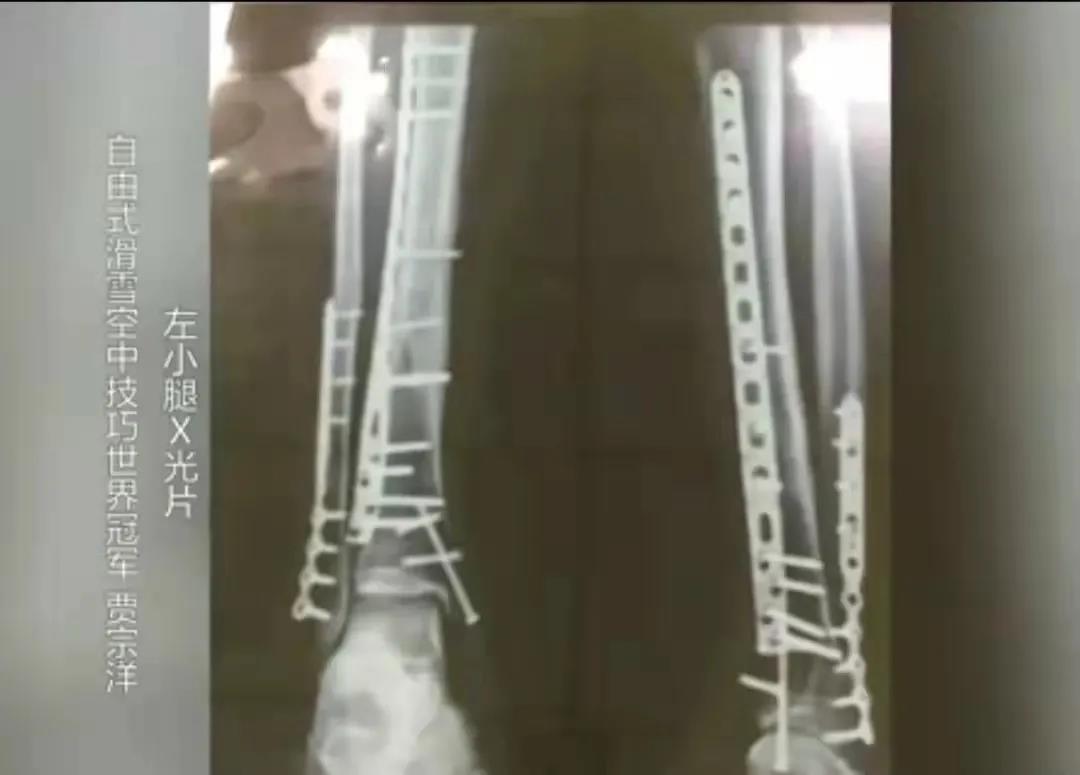 北京冬奥运动健儿努力拼搏,北京冬奥加拿大冰球队