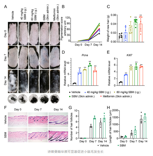 生命·发现｜我院孙洋研究团队揭示诗碧曼精华液通过激活真皮乳头细胞FGF通路促进毛发再生