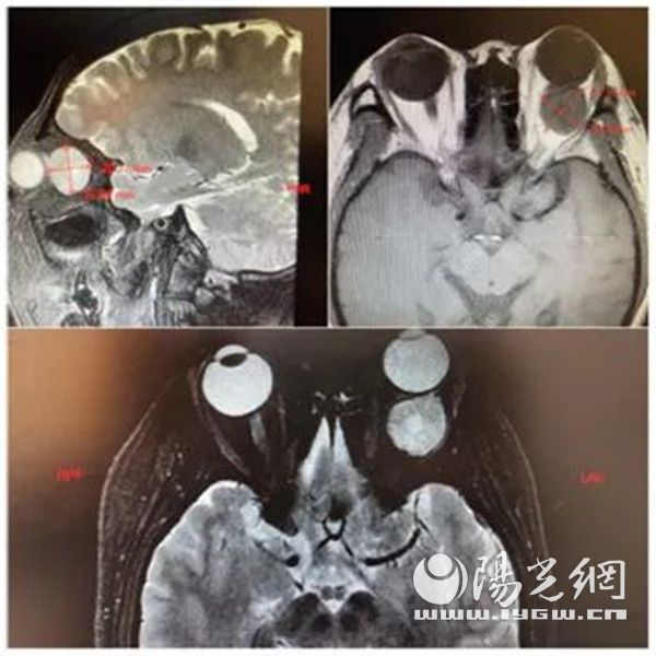 精湛的手术技巧,精湛的手术