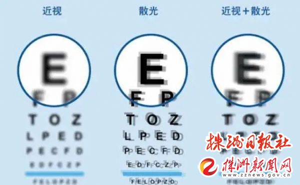 650度近视做激光手术能参军吗,想参军但是近视和散光怎么办