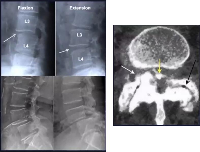 脊椎检查方法有几种,脊椎肿瘤做什么检查