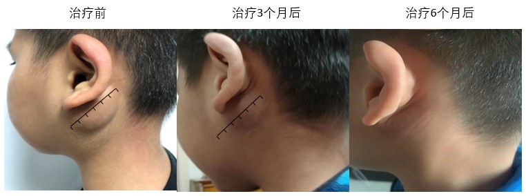 西安交大二附院试药,西安交大二附院外用药