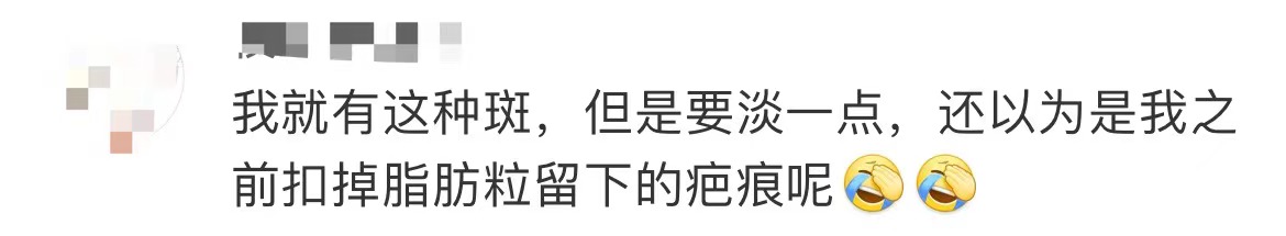 90岁后女孩熬夜10年长出老年斑,25岁女生熬夜长出老年斑和便秘