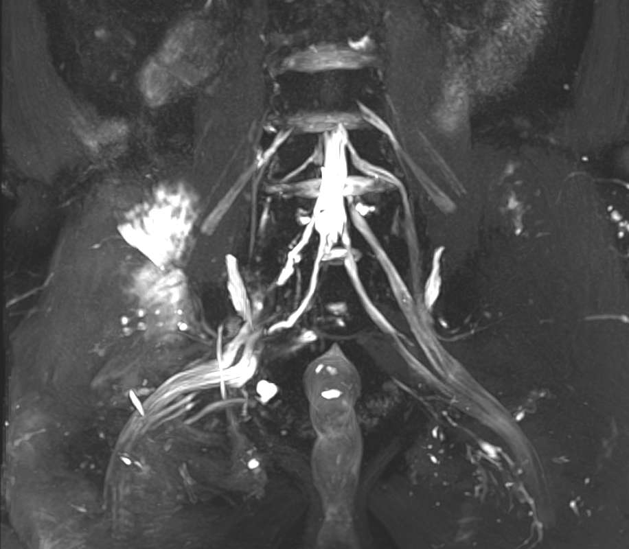北京积水潭医院全球机器人首例,北京积水潭医院机器人工程中心