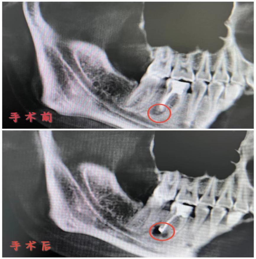 宝鸡中医医院牙疼上火挂啥科,牙科医生治疗牙痛小妙招